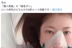 【速報】豊岡さつき(豐岡沙月)自爆罹患罕見疾病、可能致命！ ...